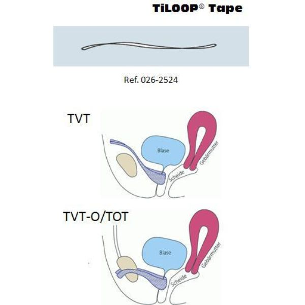 Malha Titanizada Tiloop Tape TVT/TVT-O 35 gr